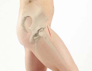Muscle Sparing Direct Anterior Approach Total Hip Replacement