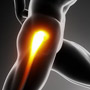 Comprehensive Non-operative Hip Arthritis Management